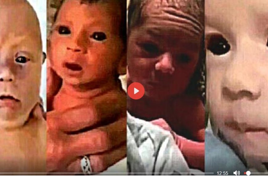 BLACK EYED PANDEMIC BABIES