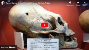 Secret Filming Of Odd Elongated Human Skulls In Bolivia