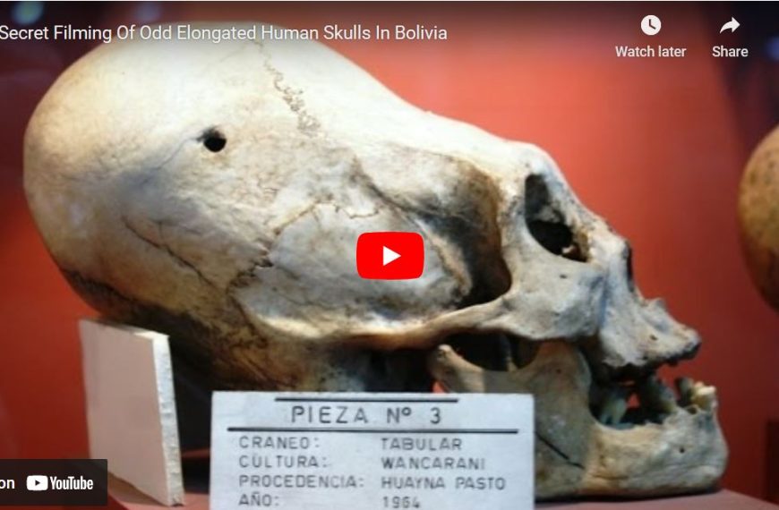 Secret Filming Of Odd Elongated Human Skulls In Bolivia